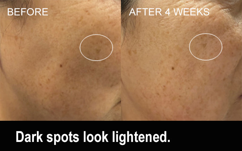 AXELIR™ ExoStem Serum with stem cell exosomes