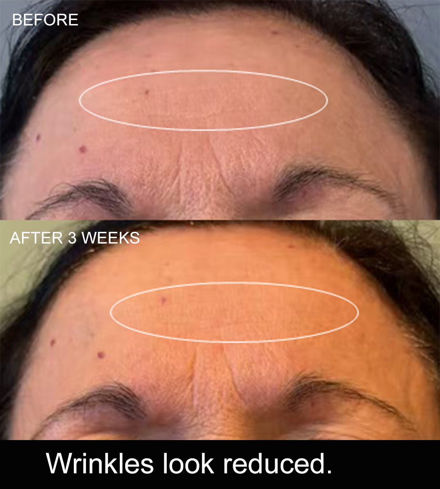 AXELIR™ ExoStem Serum with stem cell exosomes