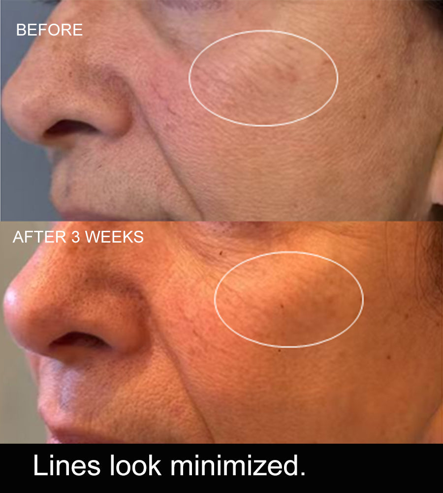 AXELIR™ ExoStem Serum with stem cell exosomes