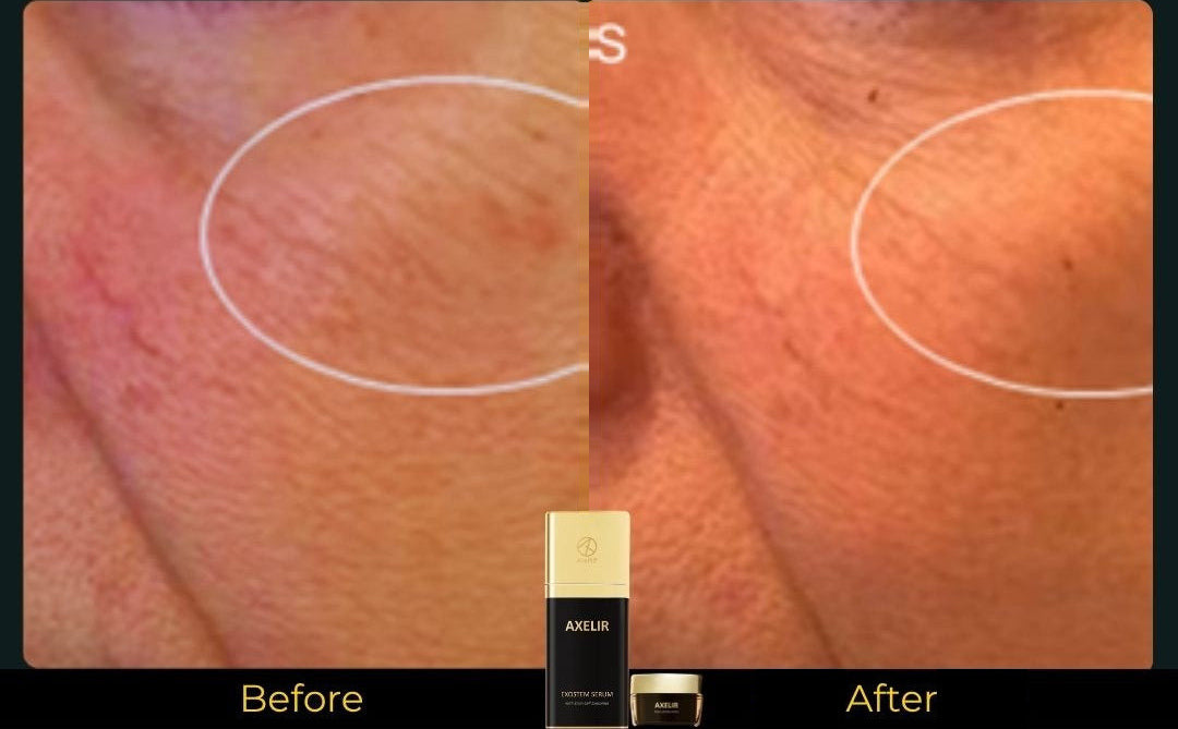 AlaR7 skincare before and after skin smoothness appearance