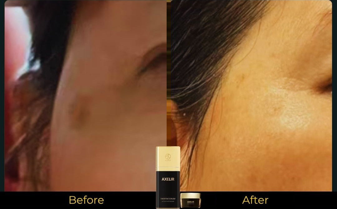 AlaR7 skincare before and after appearance of uneven skin tone