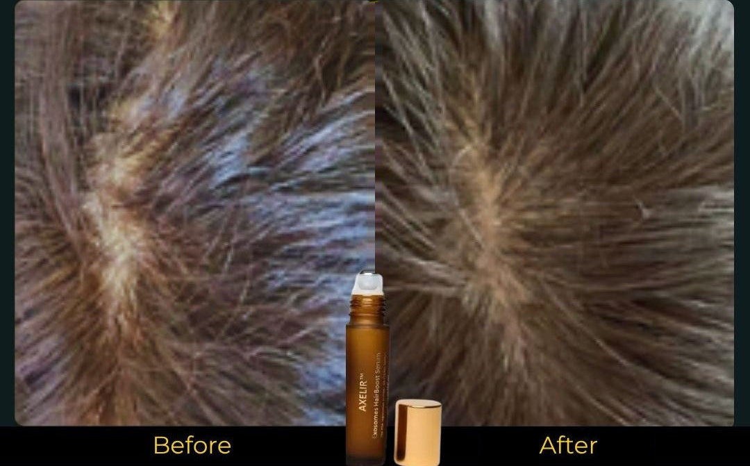 AlaR7 HairBoost before and after fuller-looking hair results: density