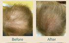 Before abd After comparision of a 86-year old  female, 2 bottles were applied twice daily for 2 months