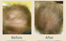 Before abd After comparision of a 86-year old  female, 2 bottles were applied twice daily for 2 months
