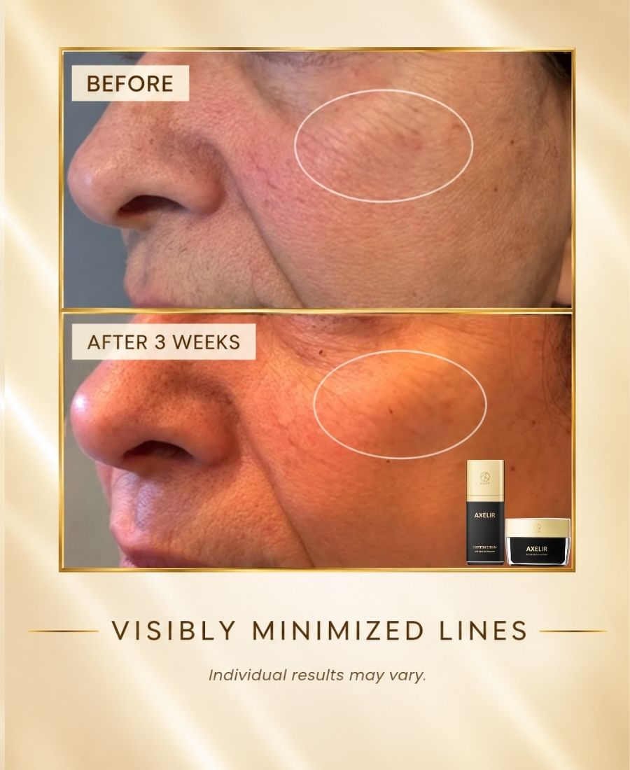 AXELIR® ExoStem Serum | Advanced Exosome Skincare | AlaR7