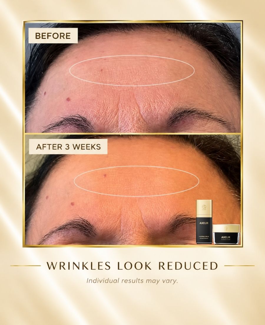 AXELIR® ExoStem Serum | Advanced Exosome Skincare | AlaR7