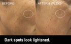 AXELIR™ ExoStem Serum with stem cell exosomes