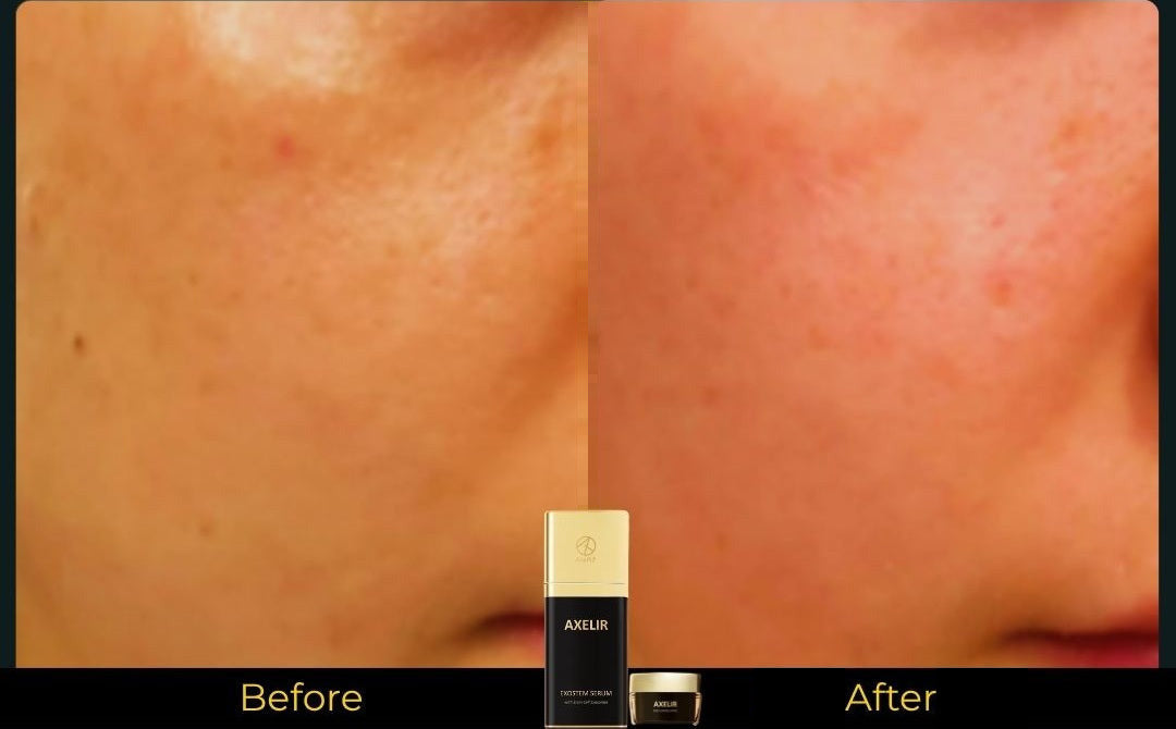 AlaR7 skincare before and after skin texture appearance