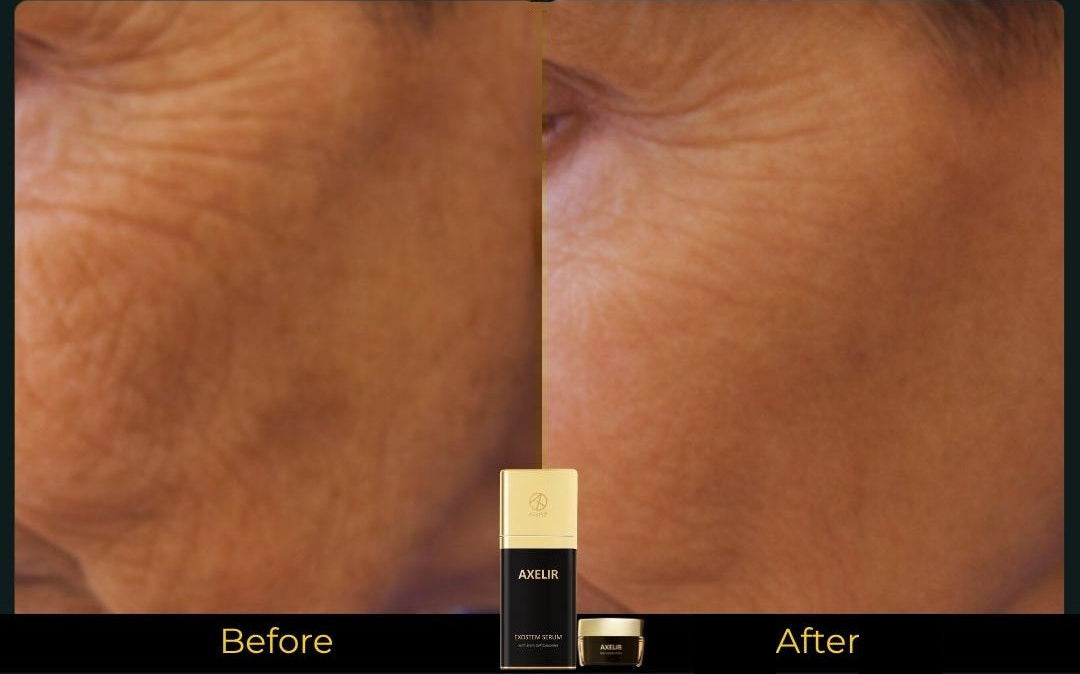 AlaR7 skincare before and after appearance of fine lines and firmness