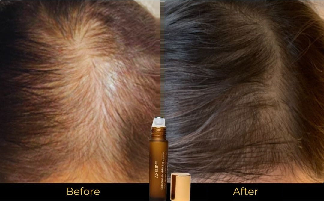 AlaR7 HairBoost before and after fuller-looking hair results: part line